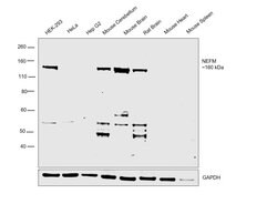 Invitrogen NEFM Polyclonal Antibody 100 &mu;g; Unconjugated:Antibodies,