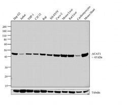 Invitrogen ACAT1 Polyclonal Antibody 100 &mu;g; Unconjugated:Antibodies,