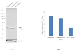 Invitrogen ACAT1 Polyclonal Antibody 100 &mu;g; Unconjugated:Antibodies,