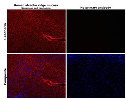 Invitrogen E-cadherin Polyclonal Antibody 100 &mu;g | Buy Online | Invitrogen&trade; | Fisher Scientific
