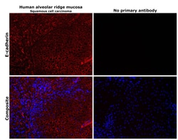 Invitrogen E-cadherin Polyclonal Antibody 100 &mu;g | Buy Online | Invitrogen&trade; | Fisher Scientific