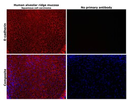 Invitrogen E-cadherin Polyclonal Antibody 100 &mu;g | Buy Online | Invitrogen&trade; | Fisher Scientific