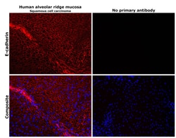 Invitrogen E-cadherin Polyclonal Antibody 100 &mu;g | Buy Online | Invitrogen&trade; | Fisher Scientific