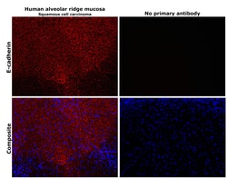 Invitrogen E-cadherin Polyclonal Antibody 100 &mu;g | Buy Online | Invitrogen&trade; | Fisher Scientific