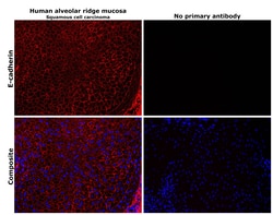 Invitrogen E-cadherin Polyclonal Antibody 100 &mu;g | Buy Online | Invitrogen&trade; | Fisher Scientific