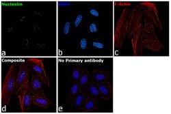 Invitrogen Nucleolin Polyclonal Antibody 100 μg; Unconjugated:Antibodies,