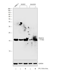 PDGF-B Polyclonal Antibody:Antibodies, Polyclonal