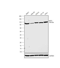 Invitrogen EEF2 Polyclonal Antibody 100 &mu;g; Unconjugated:Antibodies,