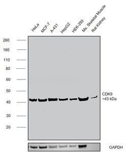 CDK9 Polyclonal Antibody, Invitrogen 200 μL; Unconjugated:Antibodies,