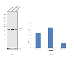 Invitrogen LDHA Polyclonal Antibody 100 &mu;g; Unconjugated:Anticuerpos