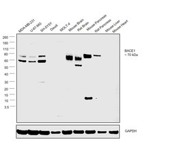 Invitrogen BACE1 Polyclonal Antibody 100 &mu;g; Unconjugated:Antibodies,
