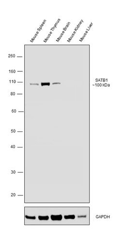 SATB1 Polyclonal Antibody, Invitrogen 100 &mu;g; Unconjugated:Antibodies
