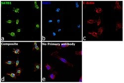 SATB1 Polyclonal Antibody, Invitrogen 100 &mu;g; Unconjugated:Antibodies