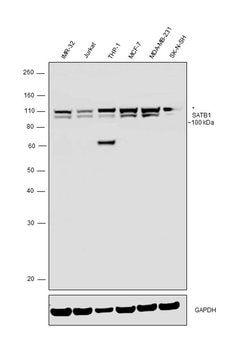 SATB1 Polyclonal Antibody, Invitrogen 100 &mu;g; Unconjugated:Antibodies