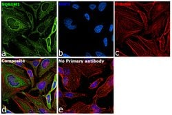 Invitrogen SQSTM1 Polyclonal Antibody 100 μg; Unconjugated:Antibodies,
