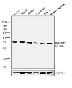 Invitrogen SQSTM1 Polyclonal Antibody 100 μg; Unconjugated:Antibodies,