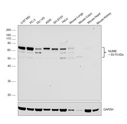 Invitrogen NUMB Polyclonal Antibody 100 &mu;g; Unconjugated:Antibodies,