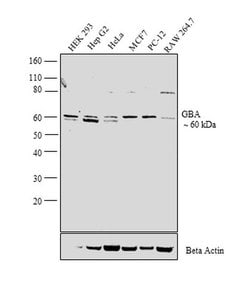 Invitrogen GBA Polyclonal Antibody 100 &mu;L; Unconjugated:Antibodies,