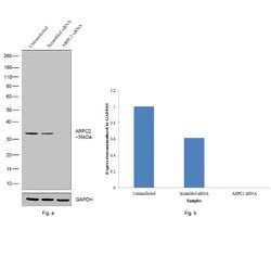 Invitrogen ARPC2 Polyclonal Antibody 100 &mu;L; Unconjugated:Antibodies,