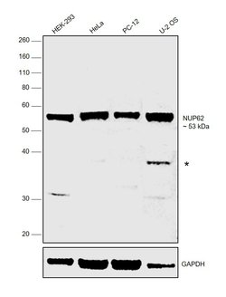 Invitrogen NUP62 Polyclonal Antibody 100 &mu;L; Unconjugated:Antibodies,