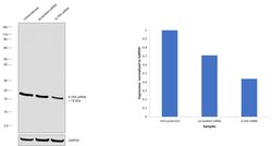 Invitrogen IL1RA Polyclonal Antibody 100 &mu;L; Unconjugated:Antibodies,