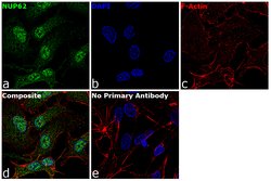 Invitrogen&trade;&nbsp;NUP62 Polyclonal Antibody