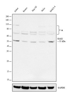 Invitrogen RAG2 Polyclonal Antibody 100 &mu;L | Buy Online | Invitrogen&trade; | Fisher Scientific