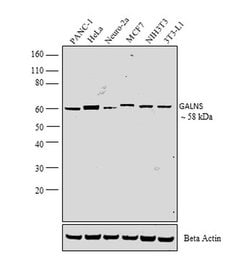 Invitrogen GALNS Polyclonal Antibody 100 &mu;L; Unconjugated:Antibodies,
