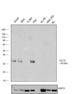 Invitrogen CD74 Polyclonal Antibody 100 &mu;L; Unconjugated:Antibodies,