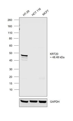 Invitrogen Cytokeratin 20 Polyclonal Antibody 100 &mu;L; Unconjugated:Antibodies,
