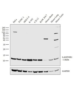 Invitrogen LAMTOR3 Polyclonal Antibody 100 &mu;L; Unconjugated:Antibodies,
