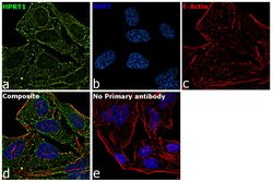 Invitrogen HPRT1 Polyclonal Antibody 100 &mu;L; Unconjugated:Antibodies,