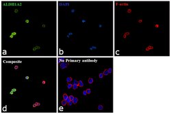 Invitrogen ALDH1A2 Polyclonal Antibody 100 &mu;L | Buy Online | Invitrogen&trade; | Fisher Scientific