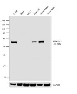 Invitrogen ALDH1A2 Polyclonal Antibody 100 &mu;L | Buy Online | Invitrogen&trade; | Fisher Scientific