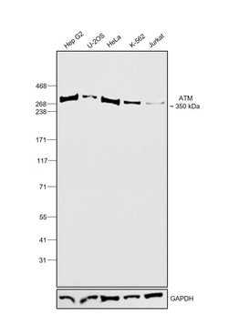 Invitrogen ATM Polyclonal Antibody, DyLight 488 50 &mu;L | Buy Online | Invitrogen&trade; | Fisher Scientific