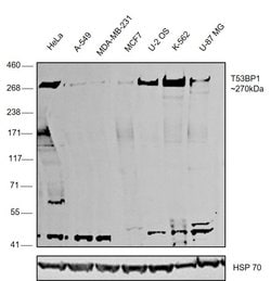 Invitrogen 53BP1 Polyclonal Antibody, DyLight 488 100 &mu;L; DyLight 488:Antibodies,