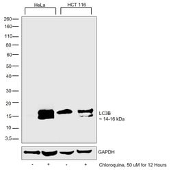 Invitrogen LC3B Polyclonal Antibody, DyLight 488 100 &mu;L; DyLight 488:Antibodies,