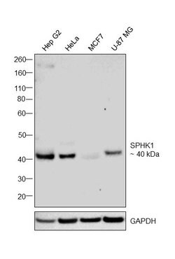 Invitrogen SPHK1 Polyclonal Antibody 100 &mu;g | Buy Online | Invitrogen&trade; | Fisher Scientific