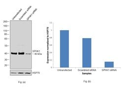Invitrogen SPHK1 Polyclonal Antibody 100 &mu;g | Buy Online | Invitrogen&trade; | Fisher Scientific