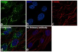 Invitrogen TGN46 Polyclonal Antibody 100 &mu;L; Unconjugated:Antibodies,