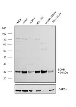 Invitrogen SDHB Polyclonal Antibody 100 &mu;L; Unconjugated:Antibodies,