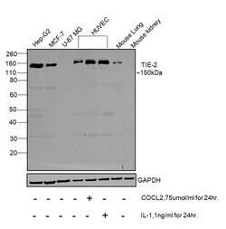 Invitrogen TEK Polyclonal Antibody 100 μL; Unconjugated:Antibodies,