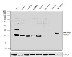 Invitrogen LAMTOR1 Polyclonal Antibody 50 &mu;L; Unconjugated:Antibodies,