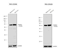 Catalase Rabbit anti-Bovine, Human, Mouse, Rat, Polyclonal, Invitrogen
