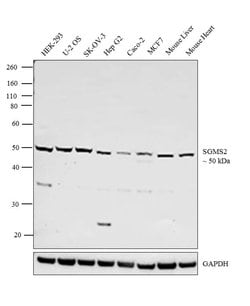 Invitrogen SGMS2 Polyclonal Antibody 400 &mu;L; Unconjugated:Antibodies,