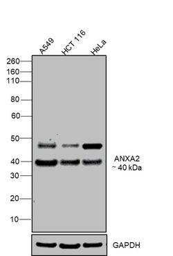 Invitrogen Annexin A2 Polyclonal Antibody 100 &mu;L | Buy Online | Invitrogen&trade; | Fisher Scientific