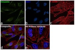 Invitrogen Vimentin Polyclonal Antibody 100 &mu;L; Unconjugated:Antibodies,