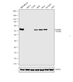 Invitrogen Vimentin Polyclonal Antibody 100 &mu;L; Unconjugated:Antibodies,