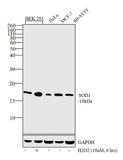 Invitrogen SOD1 Polyclonal Antibody 100 &mu;L; Unconjugated:Antibodies,