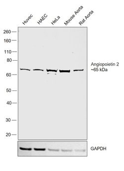 Invitrogen Angiopoietin 2 Polyclonal Antibody 100 &mu;L | Buy Online | Invitrogen&trade; | Fisher Scientific
